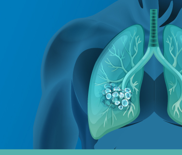 Lungs and Genetic Testing